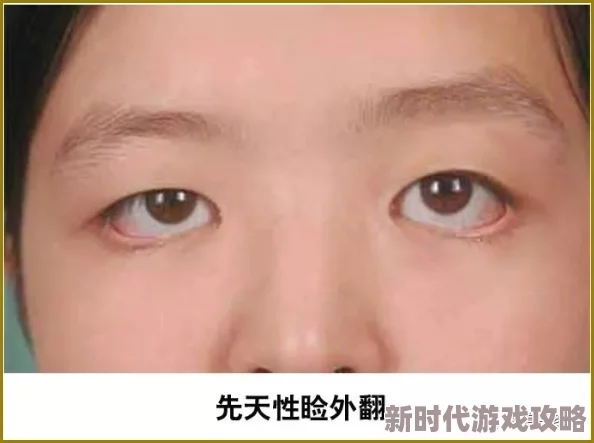 花火流眼泪翻白眼流口水医生诊断为罕见神经性疾病已开始进行针对性治疗 花火流眼泪翻白眼流口水医生诊断为罕见神经性疾病已开始进行针对性治疗