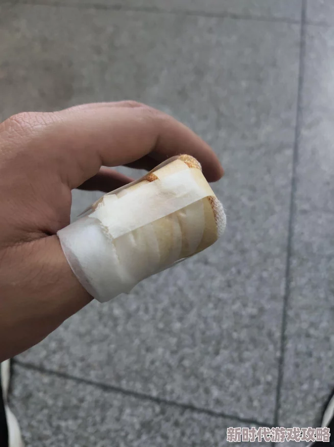 痛痛痛痛痛痛痛痛痛好大伤口已清洗包扎消肿止痛药已服用静待恢复 痛痛痛痛痛痛痛痛痛好大伤口已清洗包扎消肿止痛药已服用静待恢复