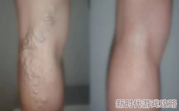 把腿抬高放墙上腿很麻怎么回事?专家解析背后原因,或与血液循环和神经压迫有关! 把腿抬高放墙上腿很麻怎么回事?专家解析背后原因,或与血液循环和神经压迫有关!