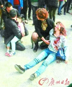 牛鞭刺进了女人的身体h近日在某地发生了一起离奇事件一名女子因玩耍不慎被牛鞭刺伤引发围观和热议