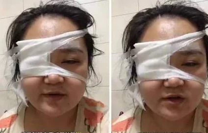 国产大屁股免费观看视频银饰