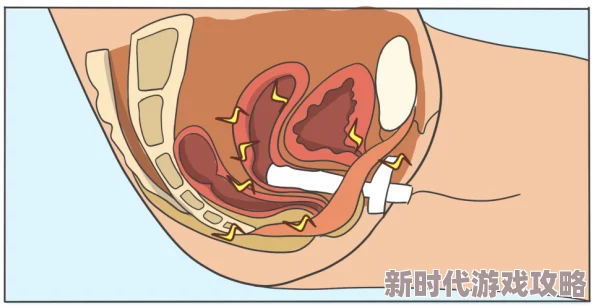 插女生阴道视频上传失败请稍后再试