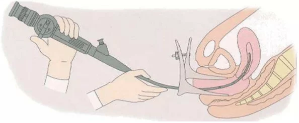 插女生阴道视频上传失败请稍后再试
