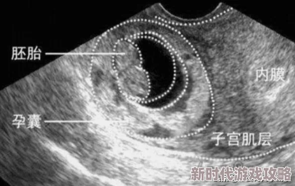 他把精子深深埋进她体内医生宣布已成功着床三个月后她孕吐严重